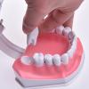 POCDOKYZ Dental Teeth Model, Tooth Model with Toothbrush, 2x Dental Mold Dentures, Teeth Model for Kids,Natural view 4
