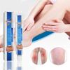 sjfscqr Vericose Veins Treatment Blue Light Lazer Treatment Pen,Spider Vein Treatment for Legs,Varicose Veins Blue Light Therapy Set view 2