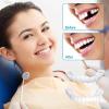 Brigtviee 2 Pairs Fake Teeth Temporary Denture Teeth Veneer Snap in Teeth Confidence Smile Dentures Veneers Fake White Teeth for Men and Women Bad Teeth Whitening Alternative view 2