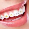 Neamou Tooth Gems Crystals | Fashionable Teeth Jewelry Gems - Reflective Tooth Multi Shaped Gems for Teeth Decoration, Dazzling Smiles for Dating, Travelling, Bar view 3