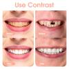 Care Spring 2 Pairs Clip in Veneers Teeth Temporary Dentures Adjustable for Teeth Whitening, False Teeth Veneers Top And Bottom, Instant Veneers Dentures Clip Fake Teeth Covers for Women And Men view 4