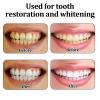 Brigtviee 2 Pairs Fake Teeth Smile Beautiful Snap on Instants Veneers Dentures -Perfect Teeth Veneer and Whitening Replacement No Pain No Shot No Drilling Fixs Smile in Minutes view 4