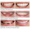 Wttfc 2 Pairs Instant Veneers Dentures, Cosmetic Veneers Teeth Temporary Dentures Fake Teeth Smile Teeth Veneers Top And Bottom Snap on Dentures Clip in Veneers Teeth for Men Women with Bad Teeth view 3