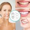 Brigtviee 2 Pairs Teeth Veneers Instant Veneers Dentures Adjustable, Smile Fake Teeth Veneer for Missing Teeth, Temporary Cosmetic Teeth, Comfort Fit Snap-On Veneers for Men and Women view 2