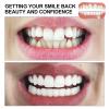 2 Pairs Temporary Teeth Dentures Instant Perfect Smile Veneers Teeth for Whitening, Silicone Dentures False Teeth Veneers Top and Bottom Cover The Bad Teeth for Men Women view 3