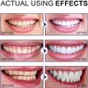 Aiposhiy Teeth Whitening Powder, Probiotic Tooth Powder, Deep Cleaning Teeth Whitening Powder, Effective Remover Stains from Coffee, Freshens Breath, 50g (10cm, 1pcs) view 4