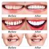 False Teeth Veneers Top and Bottom,Veneers Teeth,Clip on Veneers Top and Bottom,Forged Tooth Veneers Top and Bottom,Veneers Clip pn Top and Bottom Temporary Teeth for Confident Smile view 4