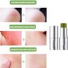 Antihistamine Cream for Bites,Antihistamine Cream for Insect Bites,Balm Stick, Mosquito Bite Itch Relief, Protect Your Skin,Easy to Carry Travel Stick (1 pcs) view 3