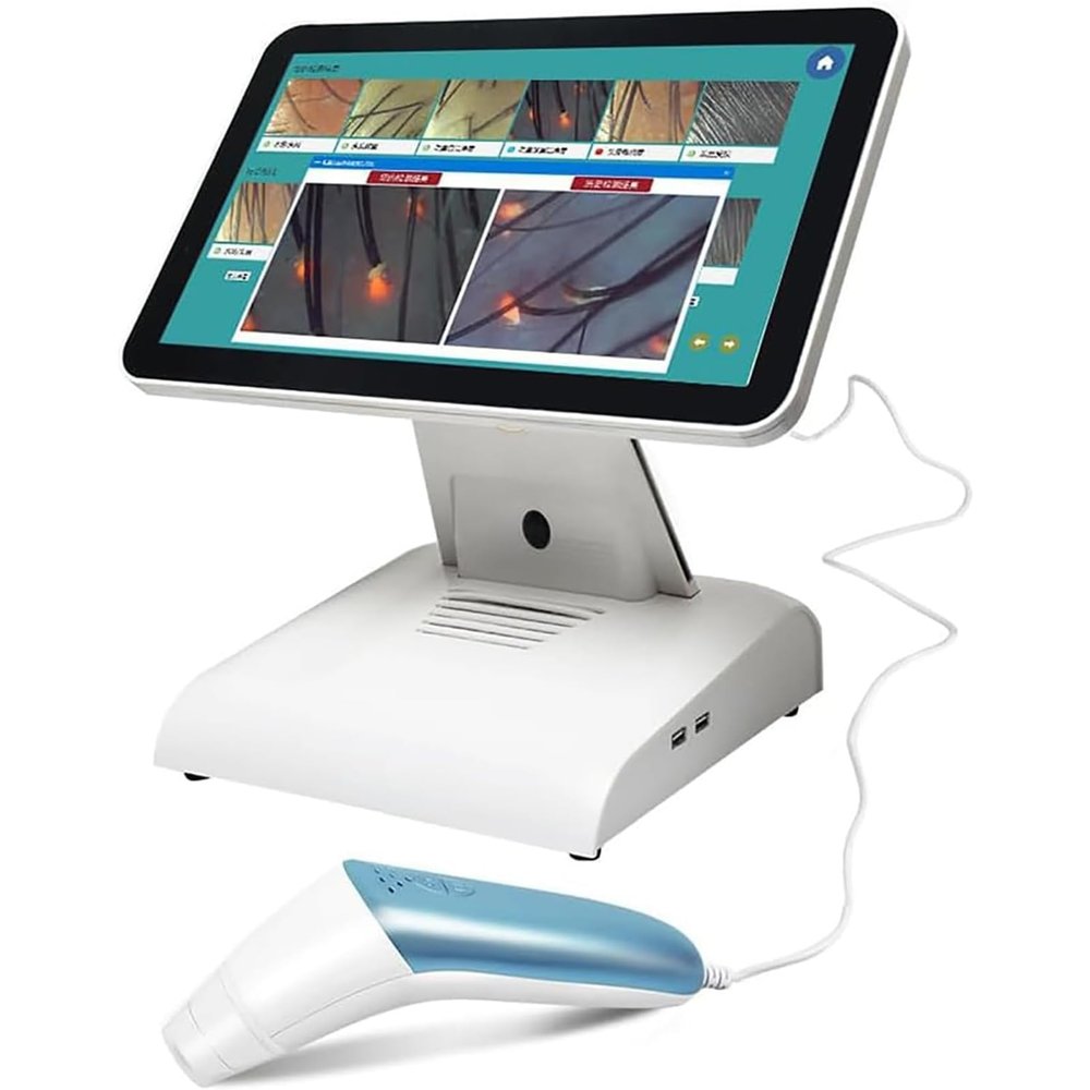 Hair Follicle Analyzer Skin Hair Scalp Detection 15 Inch 8 Million Pixels, for Beauty Salon Business, Analysis Record Archive - 640x480 Frame Rate