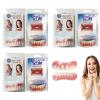 Denture Reliner Kit,3 Set Soft Denture Reline Kit,dentures, Denture Reliner Kit Snap On Soft Denture Reliner Kit for Upper and Lower Denture Soft Reline Kit for Dentures Adjustable Snap-On Dentures view 1