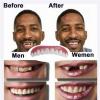 Giural False Teeth Veneers Top And Bottom Instant Veneers Fake Teeth, 2 Pair False Teeth White Temporary Dentures Clip in Veneers Teeth for Men And Women view 3