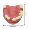 Lpitoy Maxillary Missing Dental Implant Model Oral Teeth Model with Soft Gums Tooth Implant Practice Medical Educational Training Aid Teaching Aids view 2