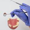 Lpitoy Maxillary Missing Dental Implant Model Oral Teeth Model with Soft Gums Tooth Implant Practice Medical Educational Training Aid Teaching Aids view 3