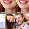 2 Pairs Instant Veneers Dentures Fake Teeth Braces Whitening Cosmetic Tooth Covering Teeth Top And Bottom Clip in Veneers Teeth Temporary Upper And Lower False Teeth for Men And Women view 4