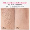 2026 New Laser Hair Removal Device, 25J Triple-Pulse Permanent IPL Hair Removal Device for Ingrown & Coarse Hair, 37F Painless Sapphire Ice Cooling Hair Removal for Legs, Facial, Armpits, Bikini view 3