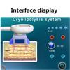 LZDOYY Freeze Slimming Machine, Fat Removal Machine Cryolipolysis Fat Lipolysis Instrument Single Head freezing Burst Fat Slimming Instrument with 3 Handles,220V view 3