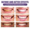 Toothpaste Premium Purple Brightening Teeth Powder Natural Formula for Effective Stain Removal and Sparkling White for Sensitive Teeth Vegan Tooth Erasers (Purple, One Size) view 4