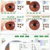 JJENXYYDS Multi-function Iris Analyzer Iris Magnifier Eye Iris Camera,Hd 12 Million Pixel Auto Focus Iris Machine with Pro Iris Analysis Software for Health Center view 4