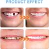 Care Spring Cosmetic Teeth Veneers 2 Pairs Clip in Veneers Teeth Top And Bottom, Silicone Dentures for Perfect Smile, False Teeth Set Temporary Dentures Covers Bad Teeth for Man & Women view 4