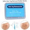 Skin Tag Removal Bands Skin Marks Remover Rubber Bands Non Toxic Facial Care Micro Strip Care Tools for Body Face 30PCS view 4