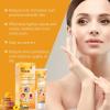 Bee Venom Mole and Wart Cream,Bee Venom Skin Tag Remover,Professional Bee Venom Repair Cream,Fast-Acting & Effective Skin Tag Remover (2PCS) view 2