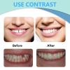 100g Temporary Tooth Repair Beads, Tooth Filling Material Replacement Thermal Adhesive Fitting Beads, Dental Denture Filler Repair Bead for Broken Chipped Tooth Fake Teeth Cosmetic Teeth Veneere view 4