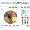 FJYAWEN 5.0 Mp USB Iris Analyzer Iridology Camera, Iris Analysis Camera, 5.0 Mp USB Left/Right Lamp Analyzer/Iridology Analysis Camera, High Resolution 2560 X 1920 view 4
