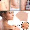 Uitseld Skin Tone Concealer Stickers | Cover up Tape Bandages | Long Lasting Scar Concealing Tape, Skin Invisible Concealer Sticker, Invisible Flaw Conceal Sticker for Skin Spots view 2