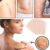 Yianyal Cover up Tape - Scar Concealing Tape,Skin Invisible Concealer Sticker, Skin Concealing Tape, Invisible Flaw Conceal Sticker for Skin Spots view 3