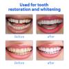 Wttfc 2 Pair Instant Veneers Dentures Fake Teeth Top and BottomBraces Whitening Cosmetic Tooth,Missing Tooth Replacement Kit, Confident Smile Comfortable Dentures for Men and Women view 2