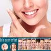 2 Pairs Cosmetic Veneers Teeth Temporary Teeth Braces Smile Teeth Smile Dentures Veneer Fake White Teeth for Men and Women for a Confident Smile  view 3