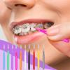 100Pcs Braces Brush for Cleaning Braces, Floss Picks Interdental Brushes Flossers for Braces Teeth Cleaning Kit Braces Toothpicks Flossing Head Cleaning Tool view 3