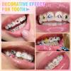 Teeth Jewelry Gems - Attractive Tooth Diys Kit, Crystal Reflective Tooth | Long Lasting Tooth Kit, 12 Styles Reflective Teeth for Halloween Decorations, Tooth Ornament Jewelry Kit view 2
