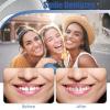 Care Spring Instant Veneers Dentures 2 Pairs Clip on Teeth Veneers Comfortable, Fake Teeth Covers Temporary Denture Top And Bottom Set, Teeth Straightening Kit for Man And Women Regain Confident Smile view 3