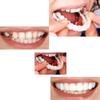 Wttfc 2 Pairs False Teeth, Instant Veneers Dentures, Bright Smile Clip on Veneers Top and Bottom,Whitening Cosmetic Clip in Veneers Teeth,Fake Teeth for Men Women with Bad Teeth view 2