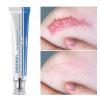 Scar Removal Cream 2pcs, Skin Repair Gel for Old and New Scars, Scar Treatment Cream for Face, Body Surgical Acne Scars, C-Section, Burns, Stretch Marks view 3