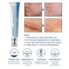 Scar Removal Cream 2pcs, Skin Repair Gel for Old and New Scars, Scar Treatment Cream for Face, Body Surgical Acne Scars, C-Section, Burns, Stretch Marks view 4