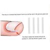 50PCS Ingrown Toenail Correction Strip Brace Kit Toenail Corrector Straightener Strip for Foot Care Tool view 2