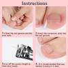 50PCS Ingrown Toenail Correction Strip Brace Kit Toenail Corrector Straightener Strip for Foot Care Tool view 3