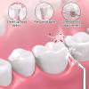 2 Pcs Replacement Tips for Waterpik Water Flosser Tips Dental Oral Irrigator Jet Replacement Heads Periodontal Pocket Plaque Remover Dental Cleaner Tool for Cleaning Tooth Implants Crowns and Bridges view 4