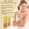 Bee Venom Scar Removal Gel, Scar Cream with Bee Venom, Stretch Mark Cream for Scar Repair, Natural Bee Venom Silicone Scar Gel, Scar Fade Gel for Smooth Skin & Long-Lasting Moisturizing Benefits view 2