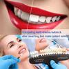 3D R-20 Teeth Shade Guide Tooth Whitening Shade Chart with 20 Colors view 4