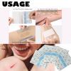 100 PCS Second Skin, Bandage Transparent Film Dressing Bandage Second Skin Dressing Protective Shield Transparent Stretch Adhesive Bandages Protective Shield view 3