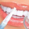 Clevermart Teeth Whitening, Clevermart Teeth Whitening Essence, Clevermart Teeth Whitening Pen, Travel-Friendly Tooth Whitening Pen (2pcs) view 2
