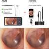 3.9mm Visual Otoscope Digital Otoscope with 4.5" Screen and 6 LED Lights - Rechargeable Battery - Great for Adults, & Pets view 3