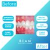 Beam Electric Dental Flosser for Teeth - Floss in 3 Minutes Includes 3 Months of Floss Heads view 4