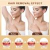 3-in-1 IPL Laser Hair Removal, 9-Level 3-Mode Adjustable Ice-Cold Hair Remover, LCD Touchscreen 999,900 Flashes Hair Removal for Women & Men, Suitable for Body, Face, Bikini Line1 view 2