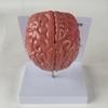 Lnfxkvva Human Brain Disease Model - Brain Pathology Brainstem Hemorrhage Medical Teaching Model - Human Brain Anatomy Model view 3