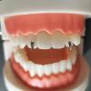 25 Pcs Tooth Gems Tooth Gem Professional Starter Kit Tooth gems Other Tooth Gem Supplies Used for Halloween view 2