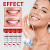 -6 Ultra Whitening Toothpaste 120G,Toothpaste -6 Brightening,Deep Cleaning Oral Care Toothpaste, Bright White Toothpaste,Teeth Whitening Toothpaste for Oral Care view 4